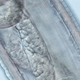 A close-up of one of the 14 Thelazia gulosa worms taken out of Abby Beckley’s eye.